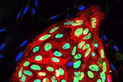 Scientists reset human stem cells to earliest developmental state