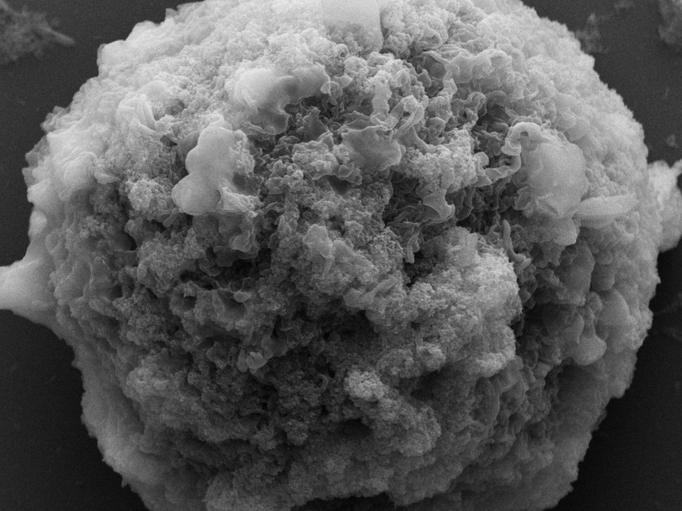 Modified cells help to cure dangerous diseases Modified cells help to cure dangerous diseases