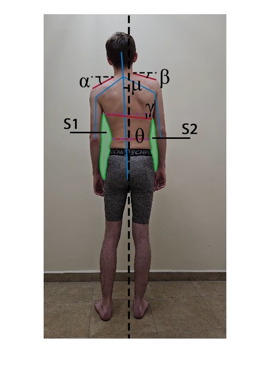 От лаборатории к клинике: разработка и внедрение системы количественной оценки двигательных функций на основе компьютерного зрения и топологических методов От лаборатории к клинике: разработка и внедрение системы количественной оценки двигательных функций на основе компьютерного зрения и топологических методов