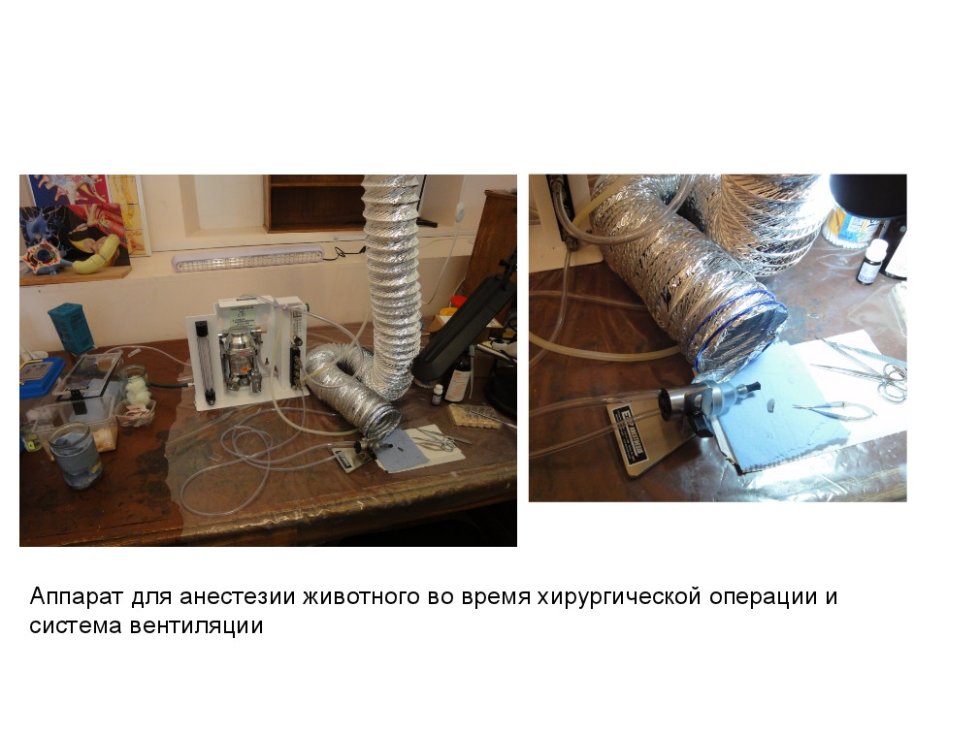 Проект 'Ранняя активность в развивающемся мозге' Проект 'Ранняя активность в развивающемся мозге'