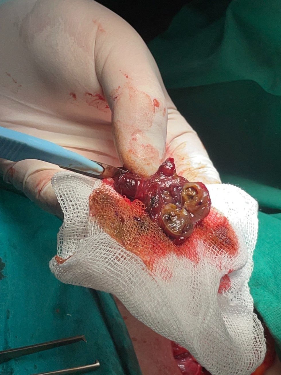 Курс по основам фотодинамической терапии Курс по основам фотодинамической терапии