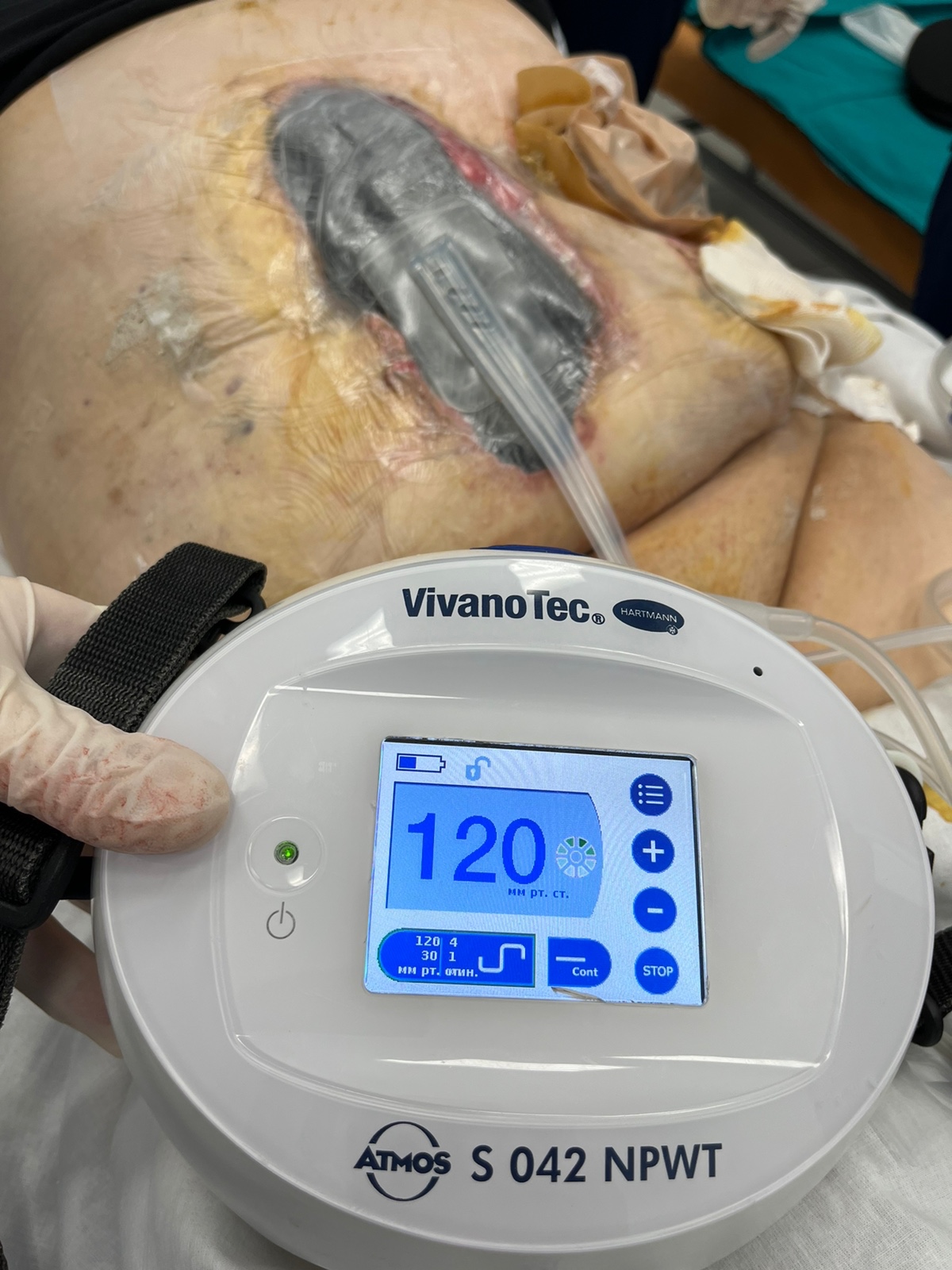 Современная методика Современная методика