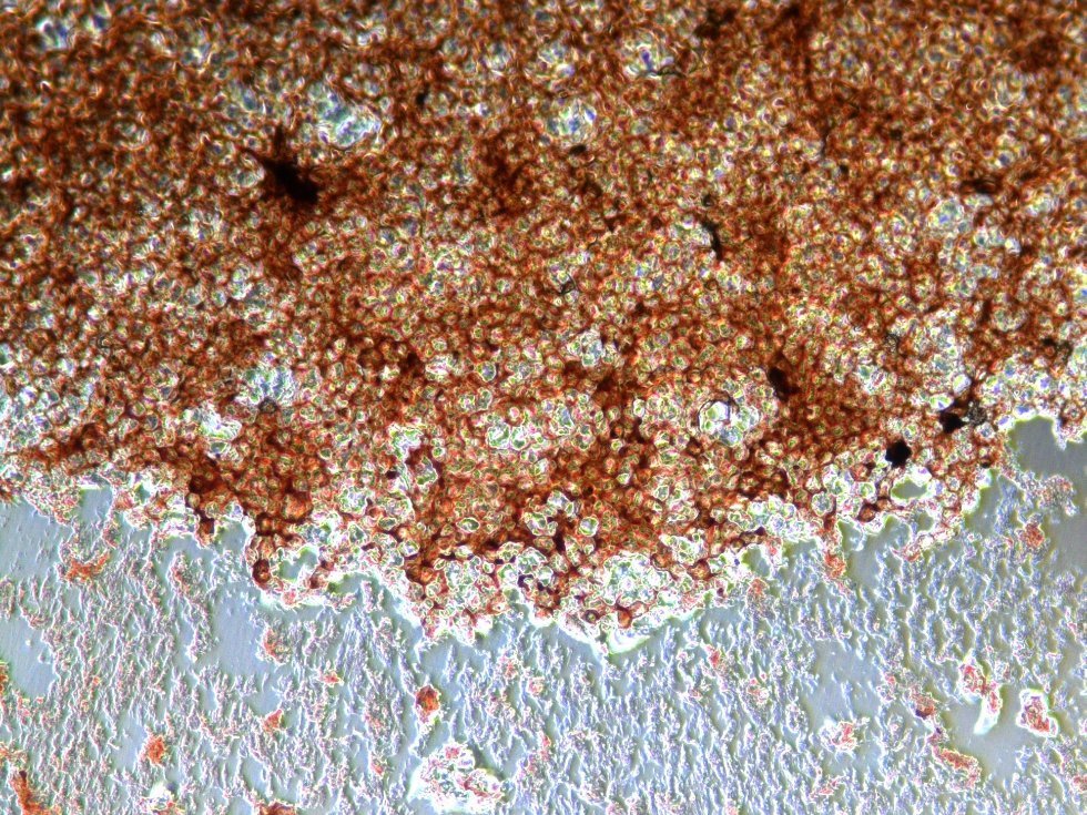 Modified cells help to cure dangerous diseases Modified cells help to cure dangerous diseases