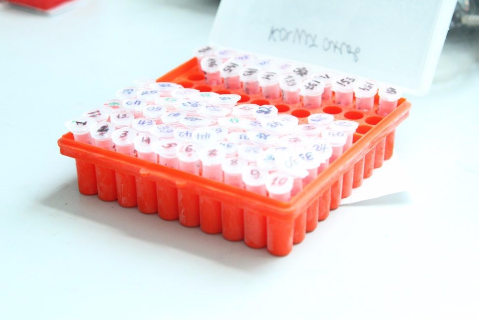 What is behind the DNA?