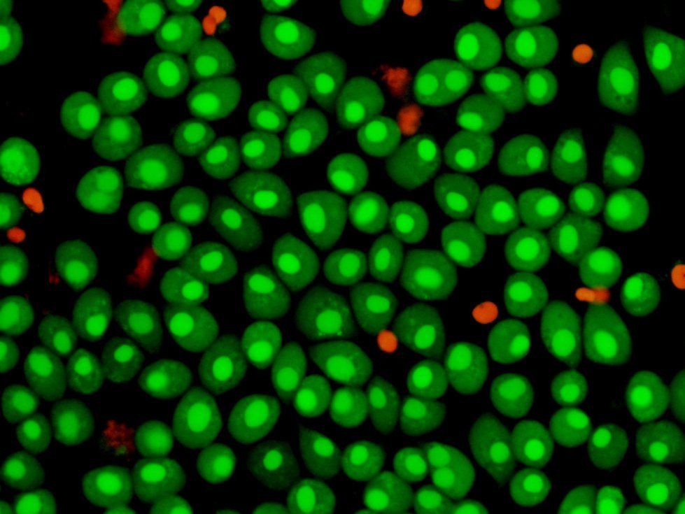 Modified cells help to cure dangerous diseases Modified cells help to cure dangerous diseases