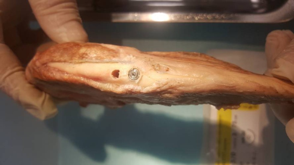 Курсы 'Дентальная имплантология (НМО)', прошедшие с 15 по 22 ноября 2017 г. Курсы 'Дентальная имплантология (НМО)', прошедшие с 15 по 22 ноября 2017 г.