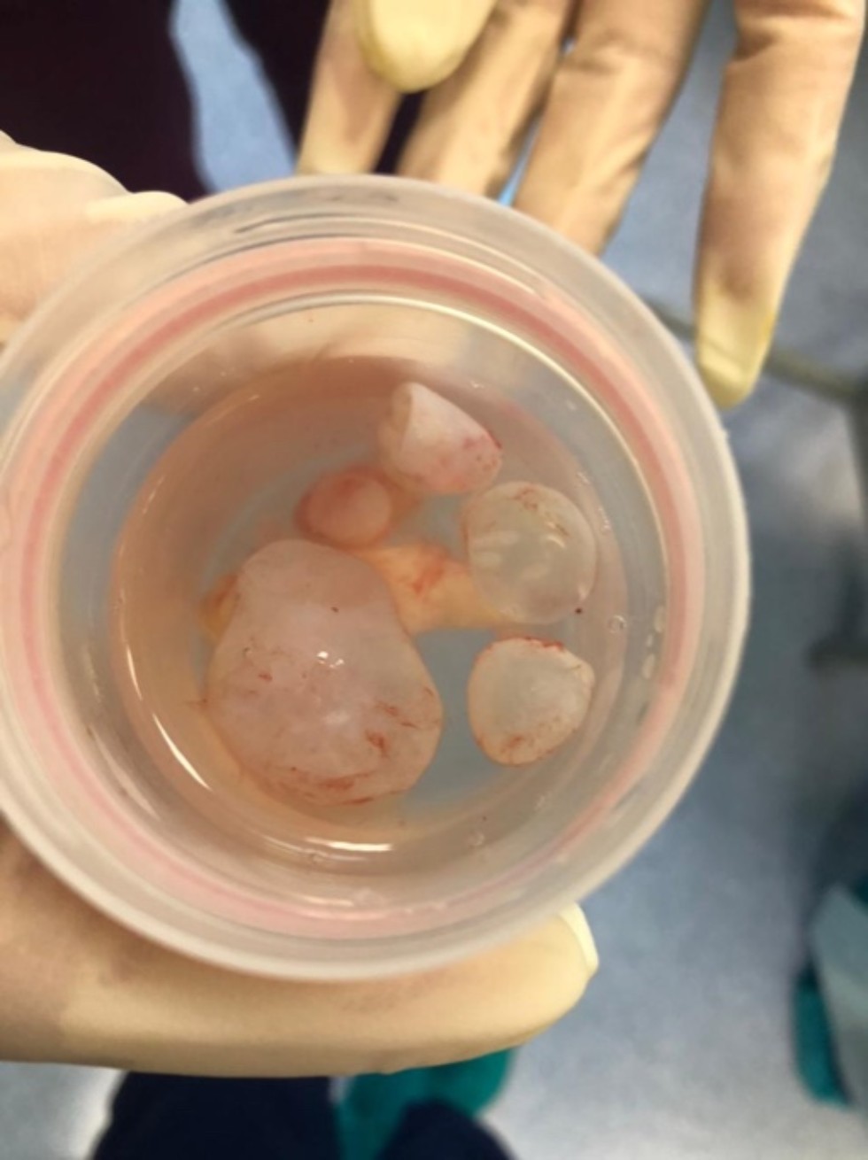 Высокотехнологичная хирургическая операция на базе Университетской клиники КФУ Высокотехнологичная хирургическая операция на базе Университетской клиники КФУ