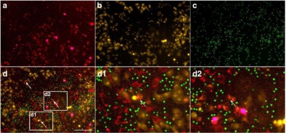 Tumor microenvironment analyzed to increase effectiveness of pre-clinical trials ,IFMB, oncology, stem cells, microvesicles