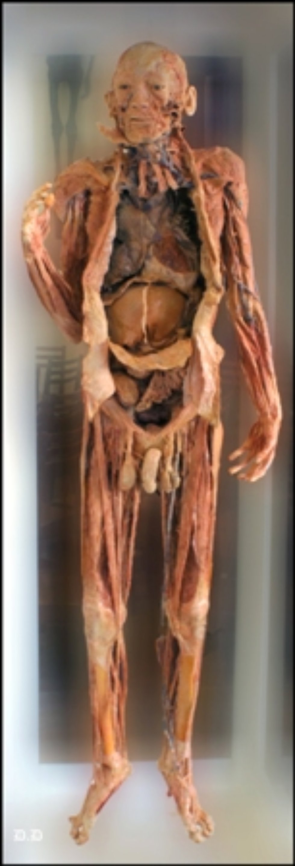 The museum of Morphology and the General Pathology Department The museum of Morphology and the General Pathology Department