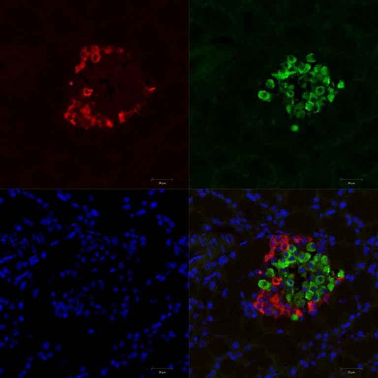 'Структурные основы регенерации поджелудочной железы' (рук. к.м.н., доц. М.С. Калигин, к.м.н., доц. С.Р. Абдулхаков) 'Структурные основы регенерации поджелудочной железы' (рук. к.м.н., доц. М.С. Калигин, к.м.н., доц. С.Р. Абдулхаков)